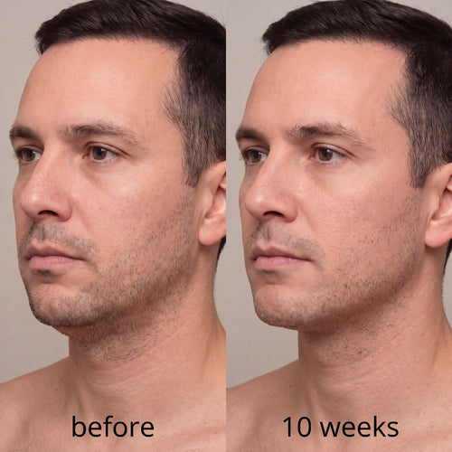 Snatched™ Collagen Face Sculpt Wrap