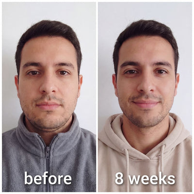 Snatched™ Collagen Face Sculpt Wrap