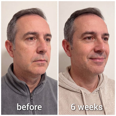Snatched™ Collagen Face Sculpt Wrap