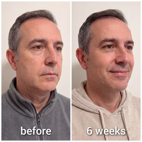 Snatched™ Collagen Face Sculpt Wrap